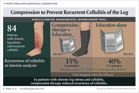 Compression Therapy for Cellulitis Prevention | Lipedema