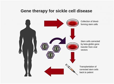 Researchers create new viral vector for improved gene therapy in sickle ...