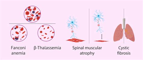 What Are Monogenic Disorders? - Classification & Most Common Types