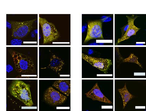 Autophagy - Dr. Sjoerd van Wijk Ubiquitination Autophagy Cell death