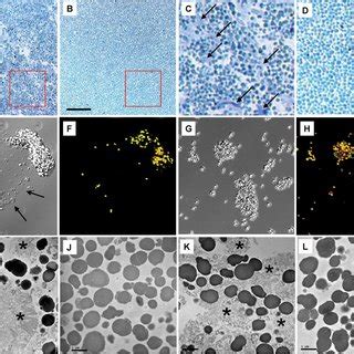 (PDF) Retinal Pigment Epithelium Lipofuscin Proteomics