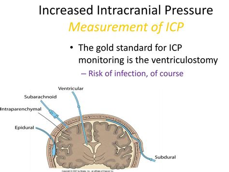 PPT - Intracranial Pressure PowerPoint Presentation, free download - ID:386938