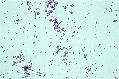 Gram-Positive Bacilli (Rods) - Microbiology learning: The "why"ology of microbial testing