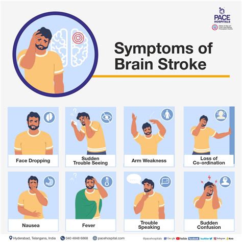 Brain Stroke: Types, Causes, Symptoms, Prevention and Treatment