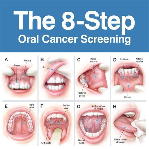 How can I tell if I have Oral Cancer? - Kiggins Family Dentistry