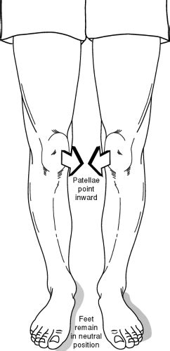 Grasshopper Patella