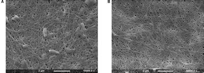 Frontiers | Chemical Modification of Bacterial Cellulose for the Development of an Antibacterial ...