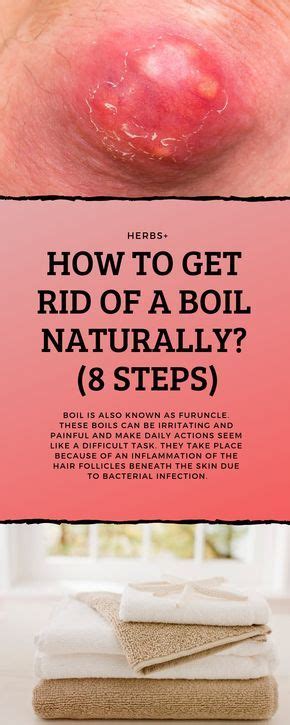 How To Get Rid of a Boil Naturally? (8 Steps) | Natural remedies for ...