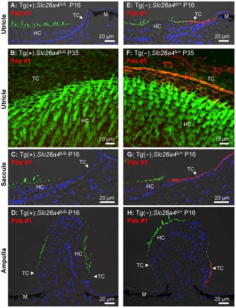 Histology and pendrin expression in the vestibular labyrinth. Staining... | Download Scientific ...