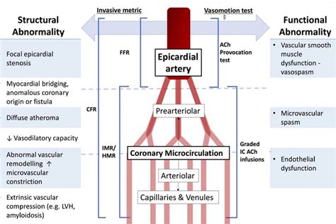 Stable coronary syndromes: pathophysiology, diagnostic advances and therapeutic need | Heart