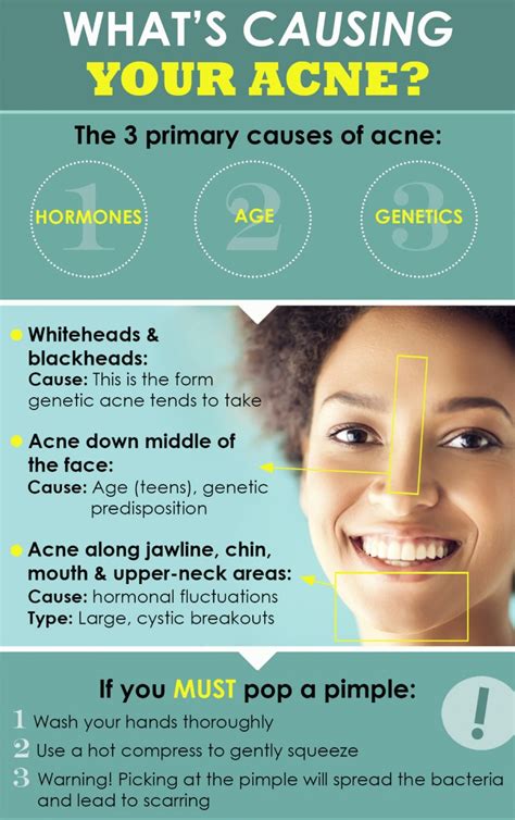 What is Acne: Types, Causes, Signs & Symptoms, Treatment