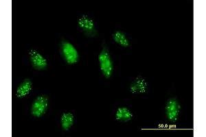 Centromere Protein B (CENPB) Antibodies