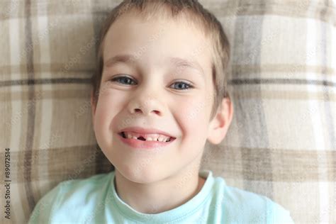 toothless smile. happy boy with a toothless smile Stock Photo | Adobe Stock