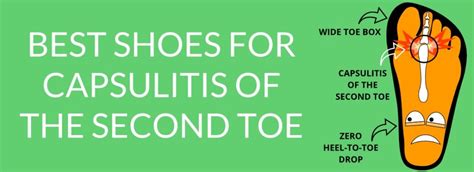 5 Effective Capsulitis Of The Second Toe Treatments You Need To Know!