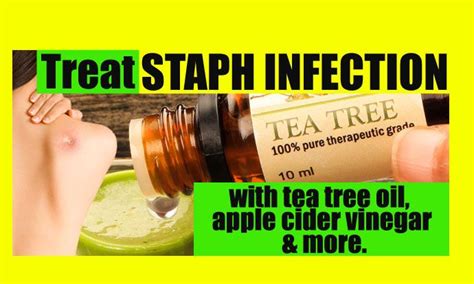 Home Remedies for Staph Infection - Page 2 of 3 | Top 10 Home Remedies