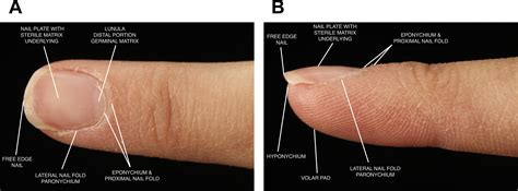 Grafting and Other Reconstructive Options for Nail Deformities - Hand Clinics