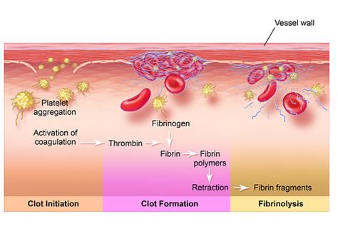 Fibrinolysis Stock Illustration - Download Image Now - iStock