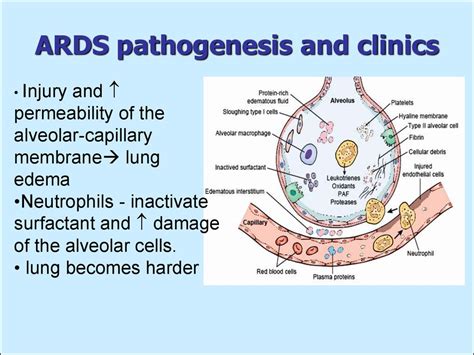 Pathophysiology Of Ards