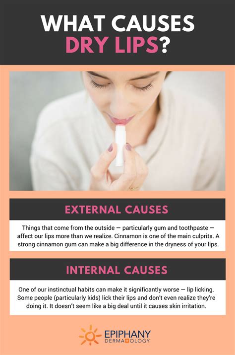 Sore Dry Lips Causes - Infoupdate.org