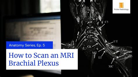 How to Scan an MRI Brachial Plexus - YouTube