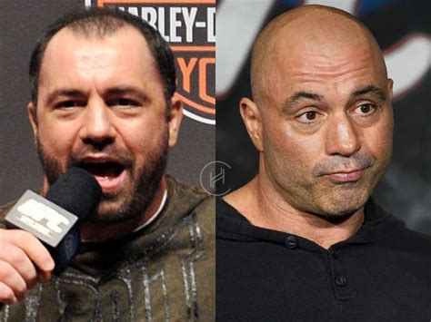 Joe Rogan Hair Transplant - Hair Loss & Technical Analysis