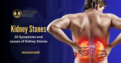 10 Symptoms and causes of Kidney Stones | Urocare Health