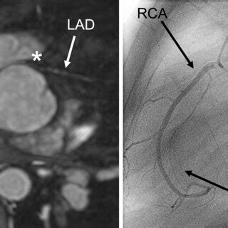 14-year-old boy born with d-TGA, post arterial Switch operation.... | Download Scientific Diagram