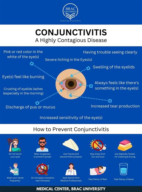 Awareness on Conjunctivitis | Brac University