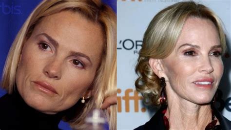 Janet Gretzky’s Plastic Surgery: Do You Know She Is 62 Years Old?