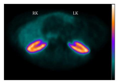 Examples of digital autoradiography (a) and a PET scan (b). Digital... | Download Scientific Diagram