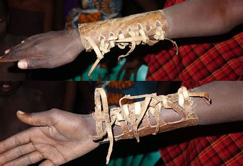 Practices and Perspectives of Traditional Bone Setters in Northern Tanzania - Annals of Global ...