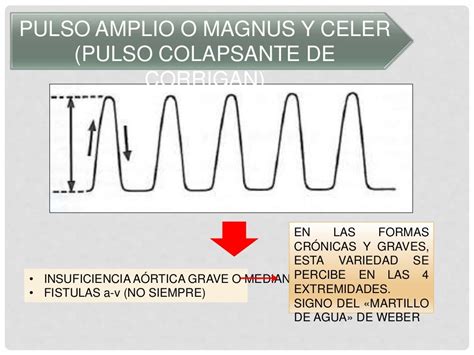 ONDAS DE PULSO