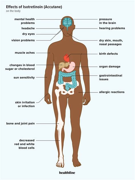 Accutane Before And After Body