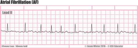 slsi.lk - how long for sulfatrim to work | With you verapamil iv dose ...