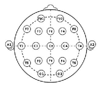 1. Electrode placement for EEG recording. | Download Scientific Diagram
