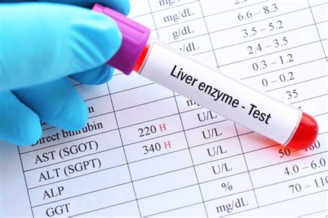 78 Abnormal liver enzymes 图片、库存照片、3D 物体和矢量图 | Shutterstock