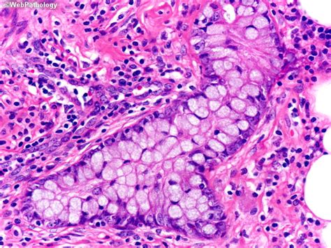 Webpathology.com: A Collection of Surgical Pathology Images