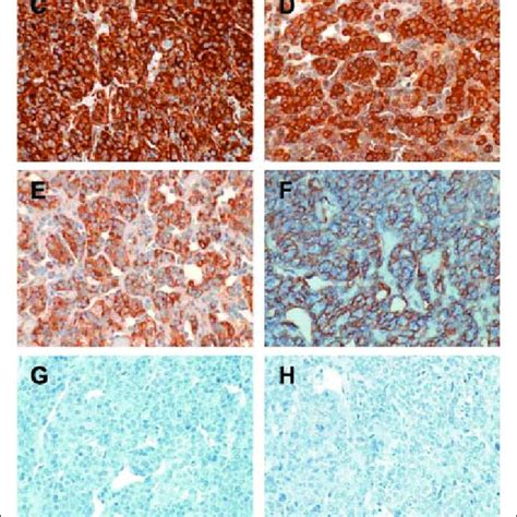 Renal glomus tumor histology and immunohistochemistry. A,... | Download ...