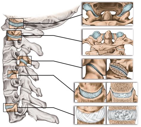 Facet Joint Pain After Spine Surgery - Texas Back Institute