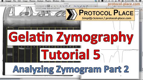 Gelatin Zymography Tutorial 5: Quantifying MMP Activity with Image J ...