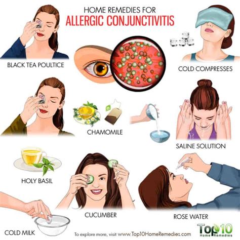 Home Remedies for Allergic Conjunctivitis | Top 10 Home Remedies