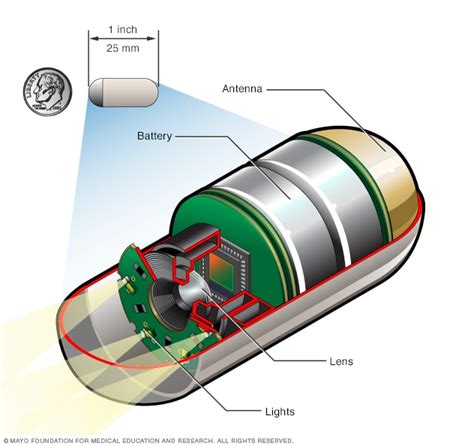 Capsule endoscopy camera - Mayo Clinic