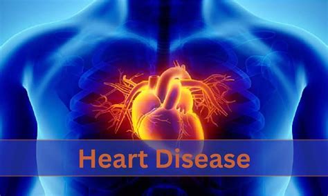 Elevated plasma methylmalonic acid levels associated with increased CV events in patients with CAD