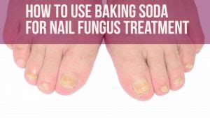 How To Use Baking Soda For Toe (& Foot) Fungus – Wellness.guide