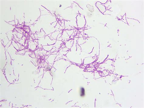 B17107 Microbial World - Valley Microscope