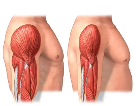 Cuándo llega la atrofia muscular y por qué razón?