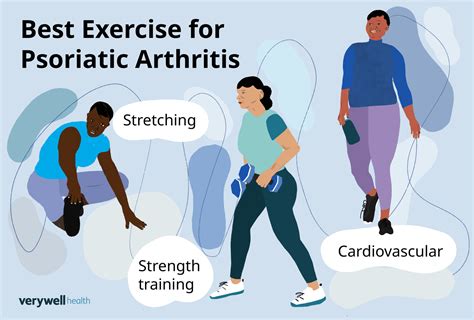 Exercises for Psoriatic Arthritis: Benefits and Tips