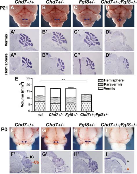 Deregulated FGF and homeotic gene expression underlies cerebellar vermis hypoplasia in CHARGE ...