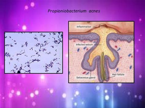 Skin microflora / Normal Flora of Skin