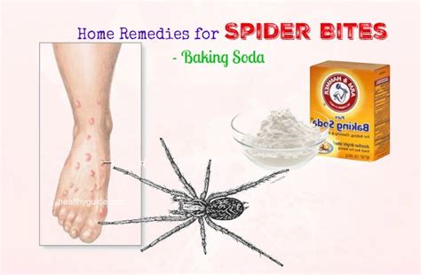 13 Natural Home Remedies for Spider Bites on Arms, Legs, Ankle, & Eyelid